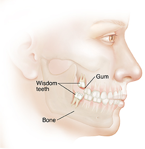 Side view of adult's face showing teeth in upper and lower jaw. Wisdom teeth are through gums with roots anchored in bone.